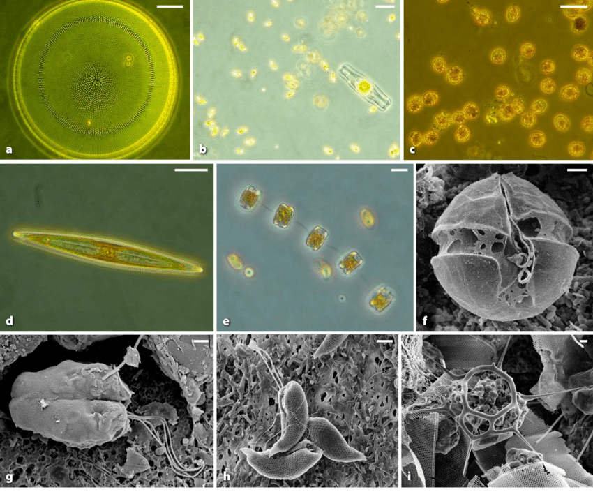 Microscopic view of diverse phytoplankton species